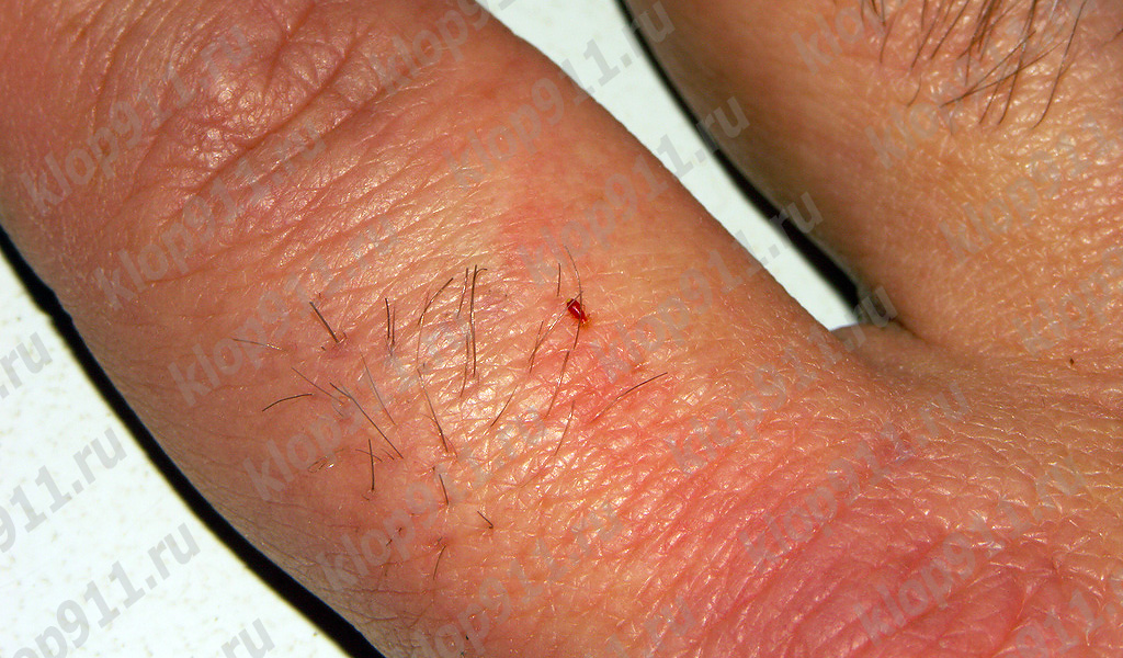La larva beu sang